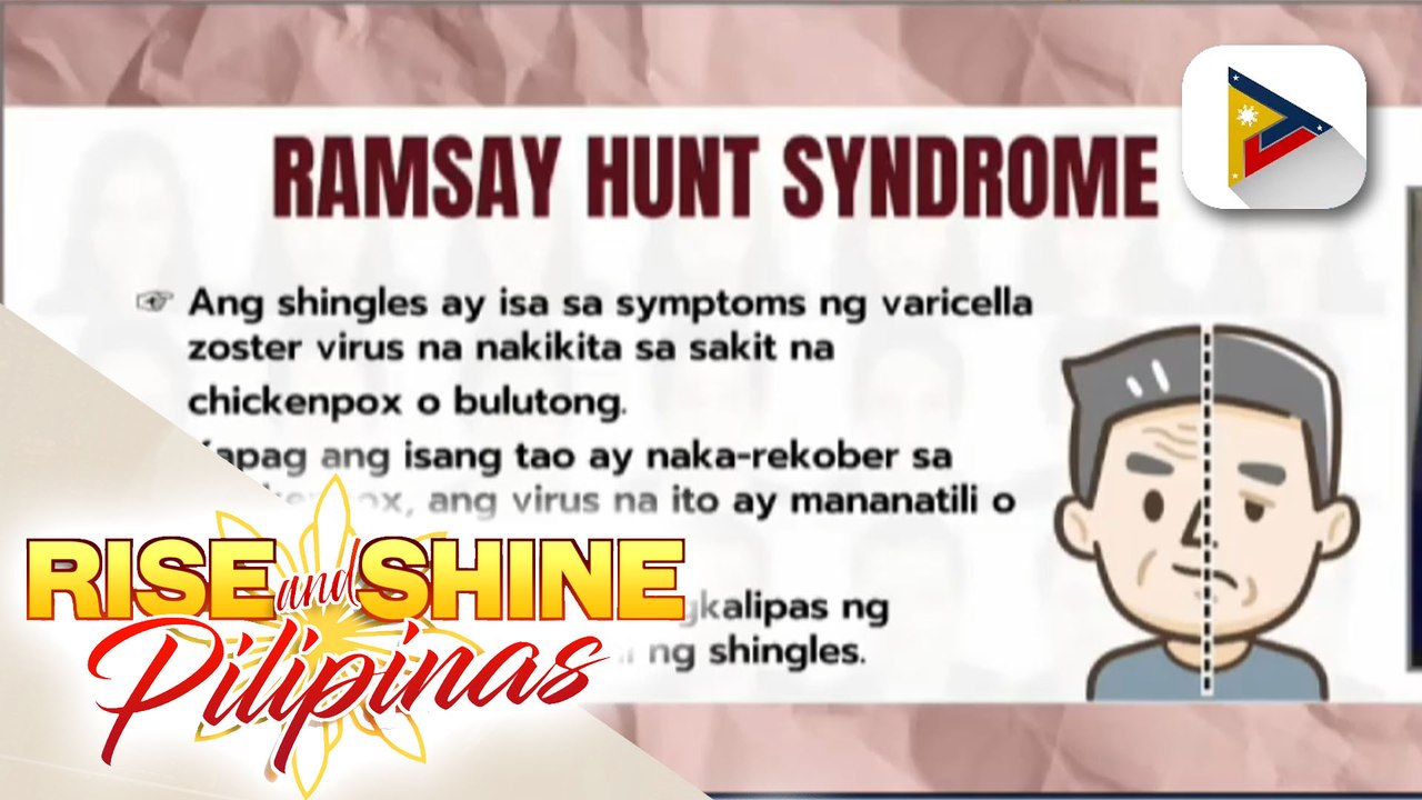 SAY NI DOK | Alamin ang patungkol sa sakit ni Justin Bieber na ramsay hunt syndrome