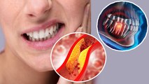 दांत में दर्द होना Heart Attack Symptoms, तुरंत कराएं जांच Watch Video | Boldsky *Health
