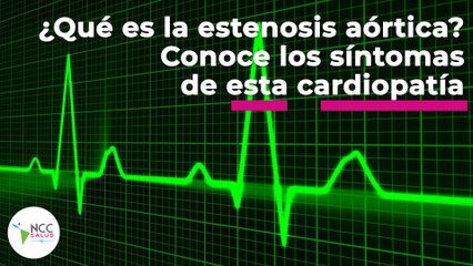 ¿Qué es la estenosis aórtica? Conoce los síntomas de esta cardiopatía | 098 | 20 al 26 de junio 2022