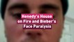 Henedy’s House on Fire and Bieber’s Face Paralysis