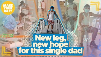 New leg, new hope for this single dad | Make Your Day