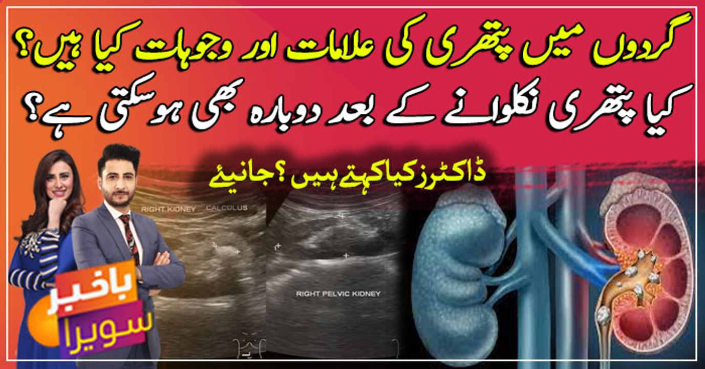 What are the symptoms and causes of kidney stones?