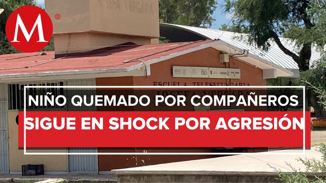 En Querétaro, agresores de Juan, niño quemado por sus compañeros, esperan audiencia