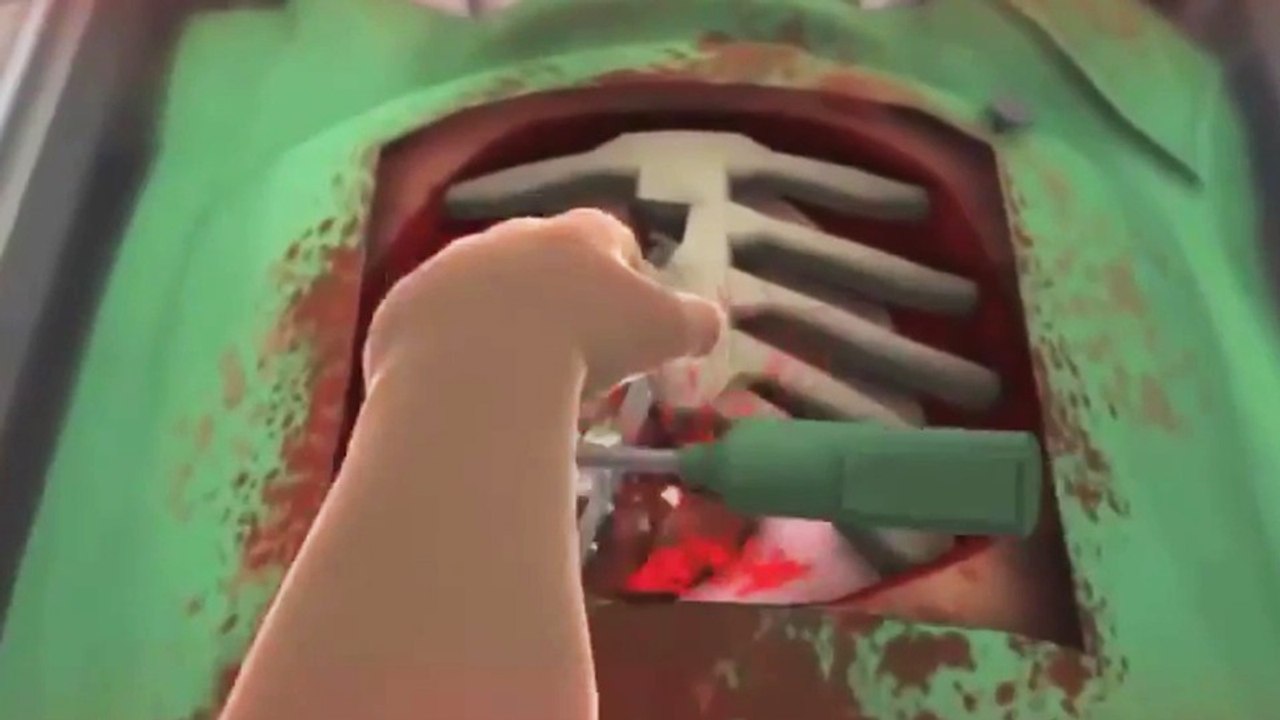 Surgeon Simulator - Anniversay-Edition für PlayStation 4 im Trailer