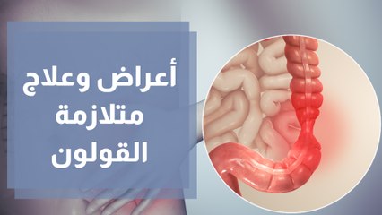كيف يؤثر تبدل الأحوال الجوية على متلازمة القولون العصبي