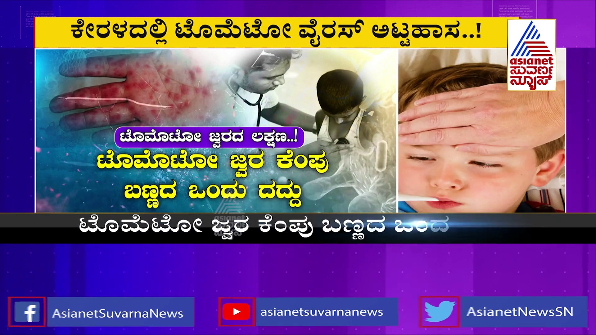 ಕೇರಳದಲ್ಲಿ ಟೊಮೋಟೋ ವೈರಸ್ ಅಟ್ಟಹಾಸ: ಕರ್ನಾಟಕದಲ್ಲಿ ಹೈಅಲರ್ಟ್‌..!