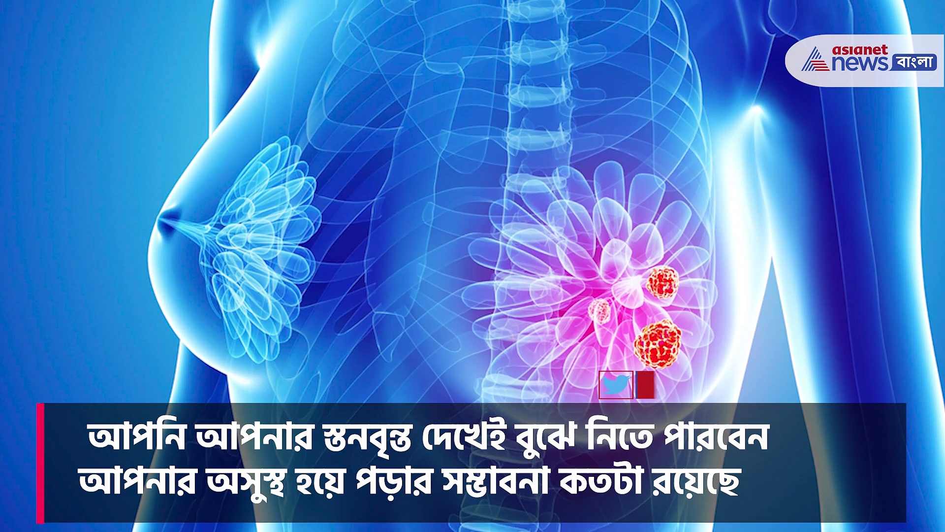 স্তন বৃন্তের বৈচিত্র বলে দেবে আপনি সুস্থ না অসুস্থ, জেনে নিন কীভাবে  