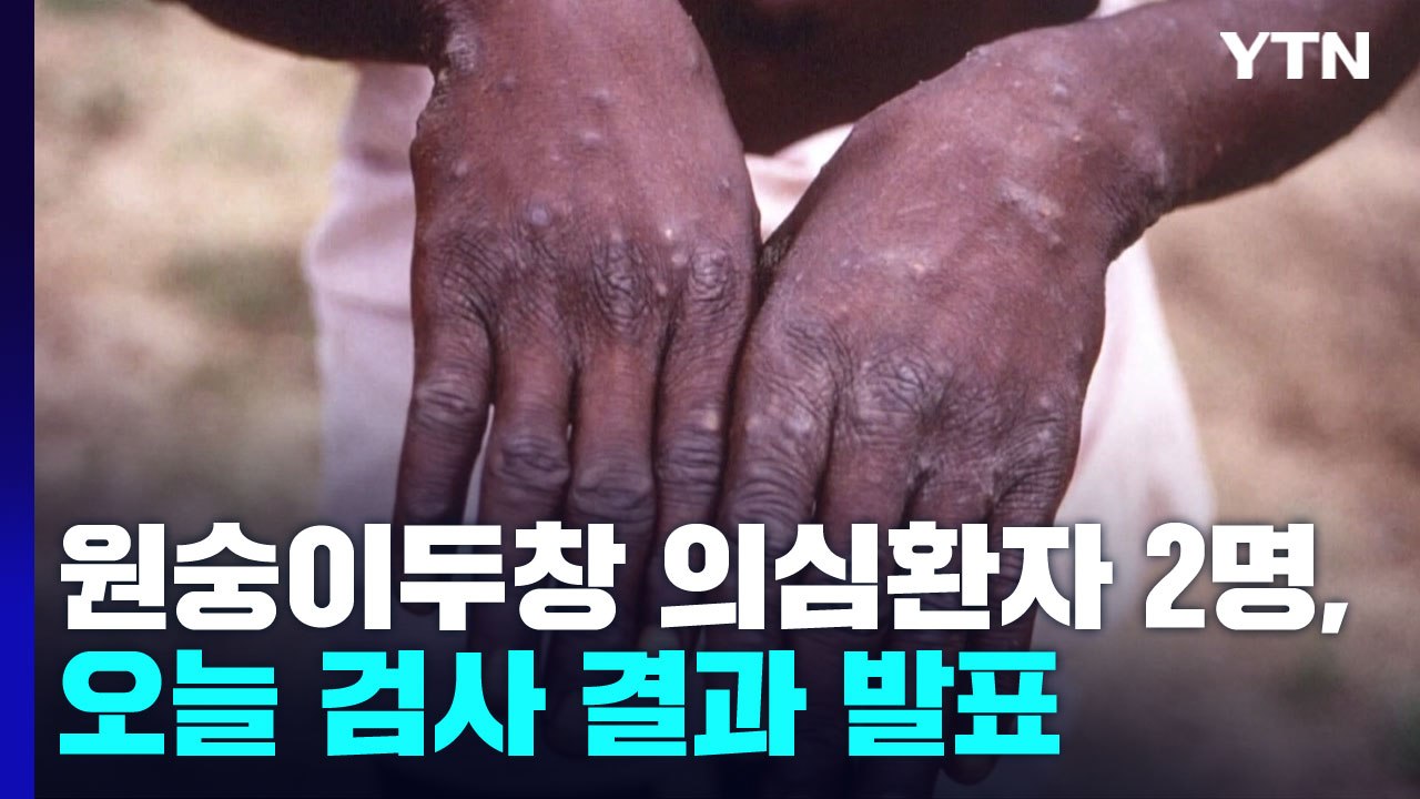 원숭이두창 의심 환자 2명, 오늘 검사 결과 발표...코로나 신규 확진 8,992명...