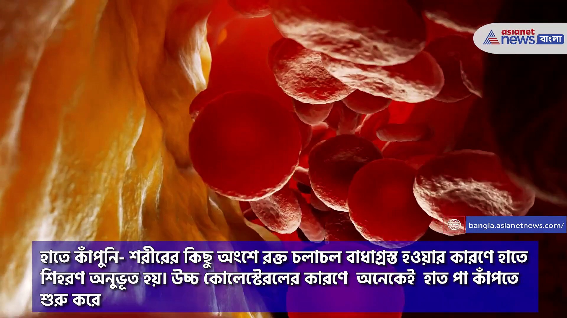 শরীরের মধ্যে বাড়ছে কোলেস্টেরল, এই লক্ষণগুলি দেখলেই সচেতন হয়ে যান 