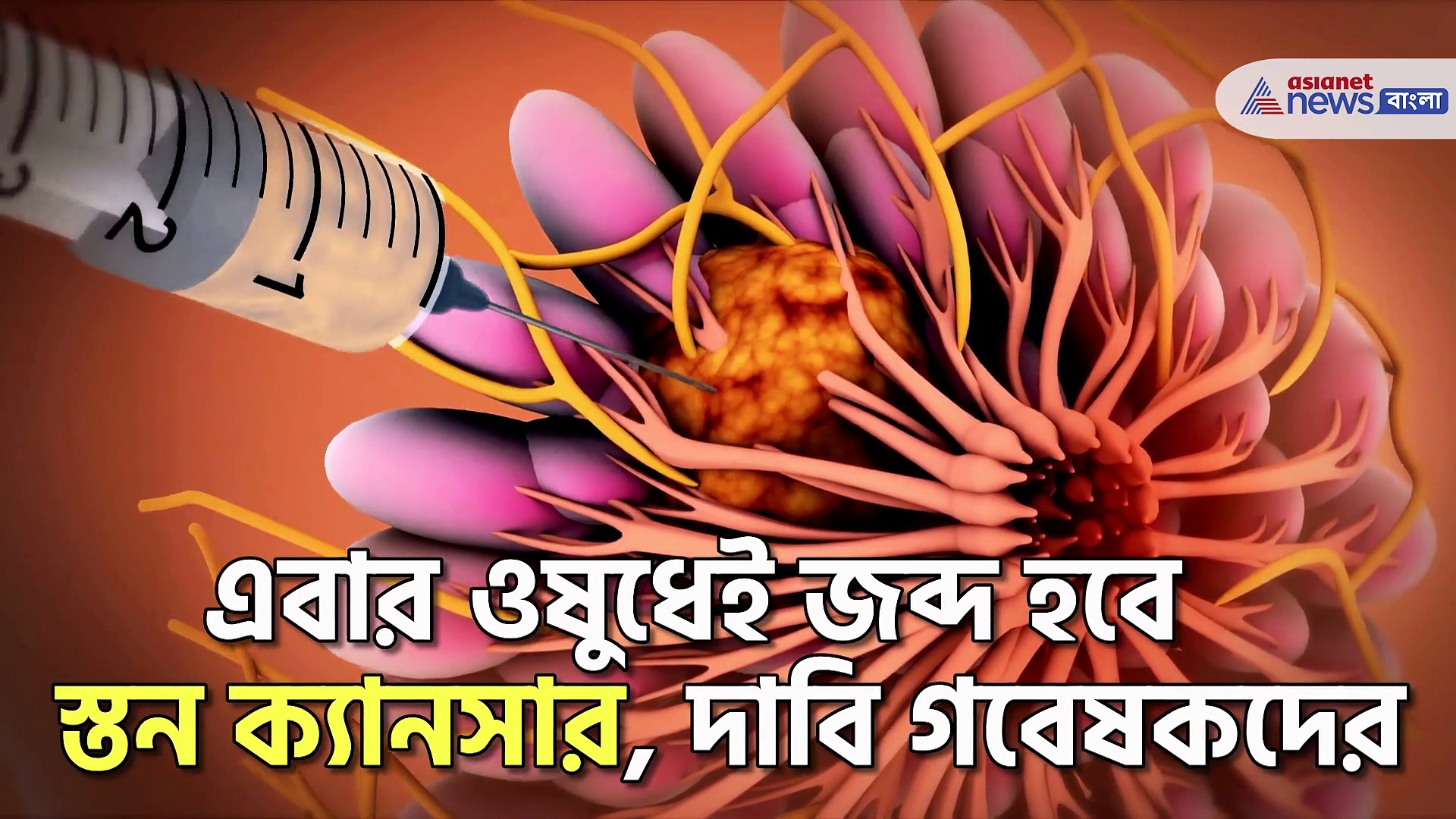 গবেষকদের নতুন আবিষ্কার, ওষুধেই সারবে স্তন ক্যানসার!