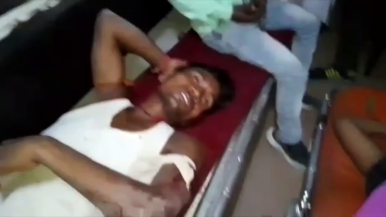 मामूली विवाद के बाद जमकर चले लाठी-डंडे, छर्रे लगने से घायल हुआ युवक फिर भी पुलिस कर रही फायरिंग से इंकार