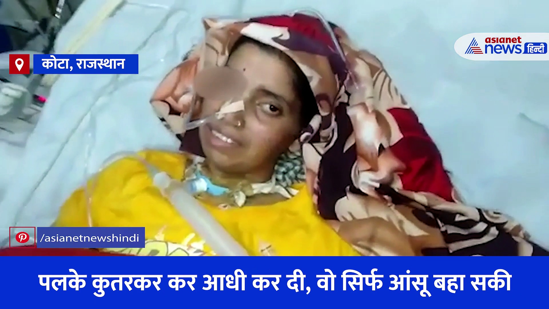 राजस्थान के कोटा में जिंदा महिला की आंख खा गया चूहा, पलके कुतरकर कर आधी कर दी वो सिर्फ आंसू ही बहा सकी