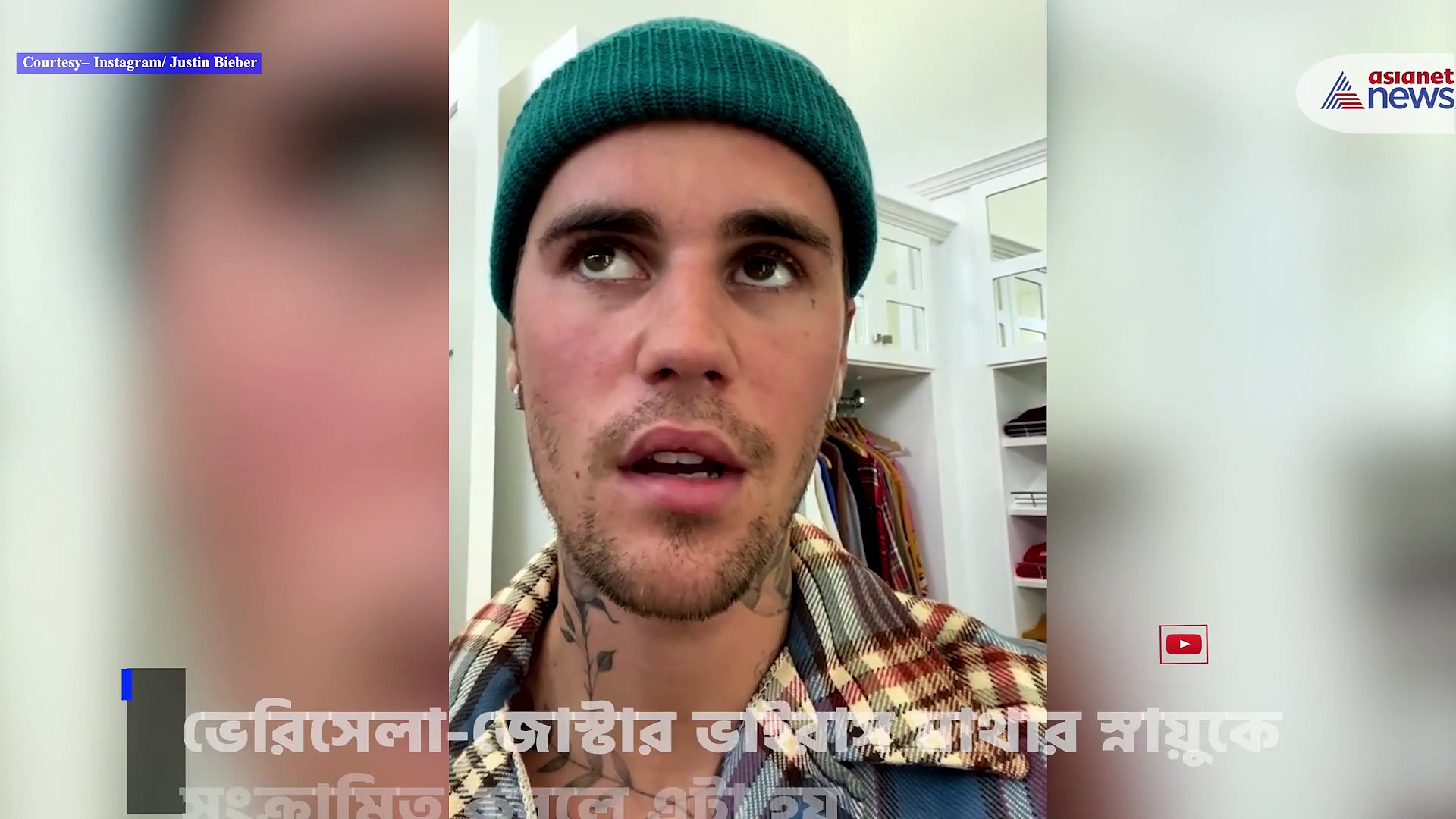  পক্ষাগ্রস্ত হয়ে গিয়েছে জাস্টিন বিবারের