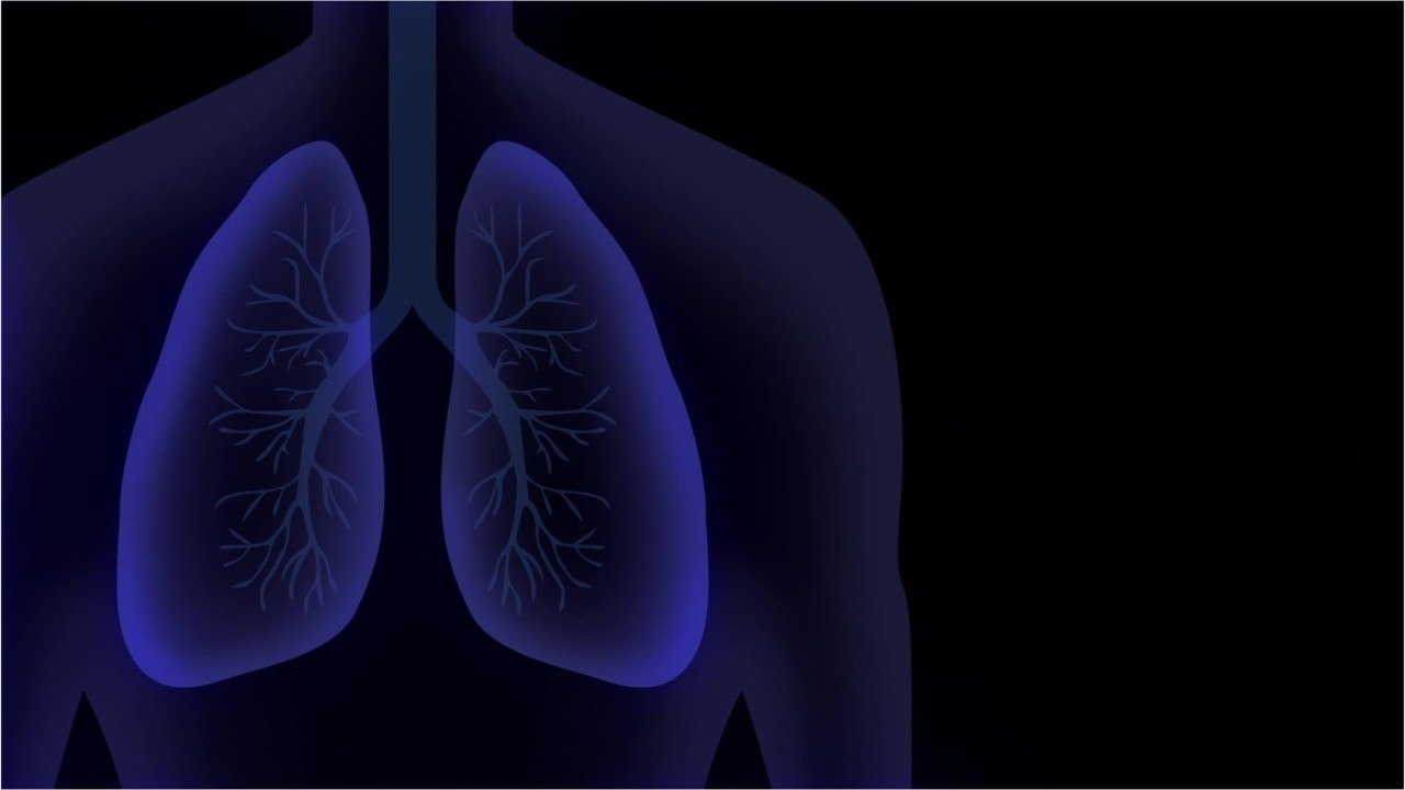 Pathologist warns Covid-19 can infect 'pretty m...