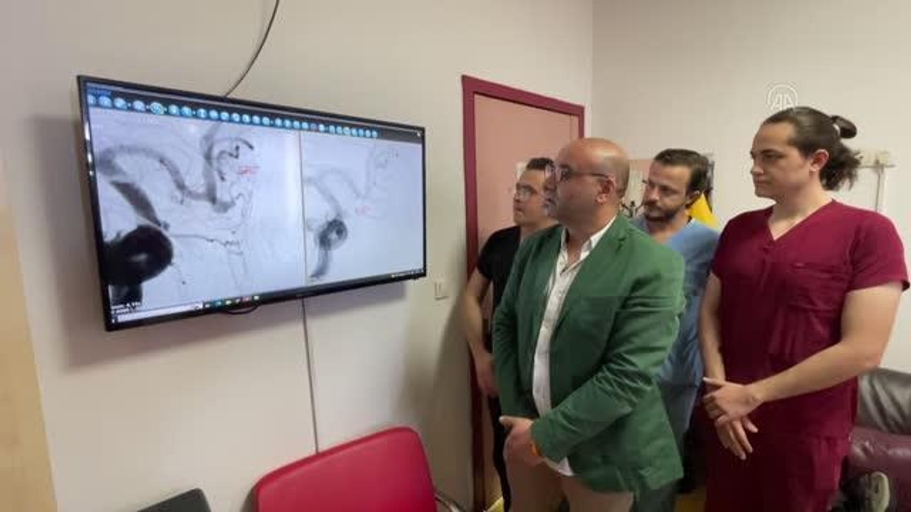 ZONGULDAK - Beyninde damar baloncuğu bulunan hasta damar içi tedavi ile sağlığına kavuştu