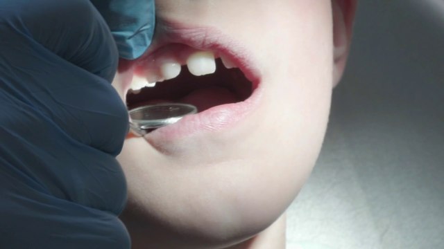 Bébés Coca : quel est ce phénomène qui inquiète les dentistes ?