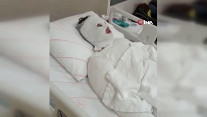 Konya'da korkunç olay... "Su saatine bakacağım" dedi, eski nişanlısına kezzap attı