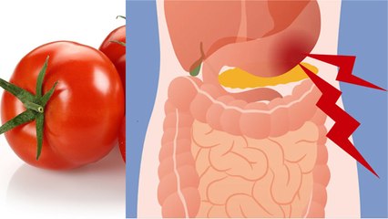 टमाटर खाना बादी होता है क्या ? । टमाटर खाने से गैस बनती है या नहीं । Boldsky । *Health