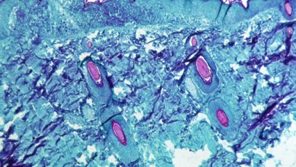 원숭이두창 환자 국내 첫 발생...위기경보 '주의' 격상 / YTN