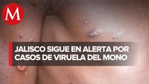 Monitorean posibles casos de viruela del mono en Jalisco