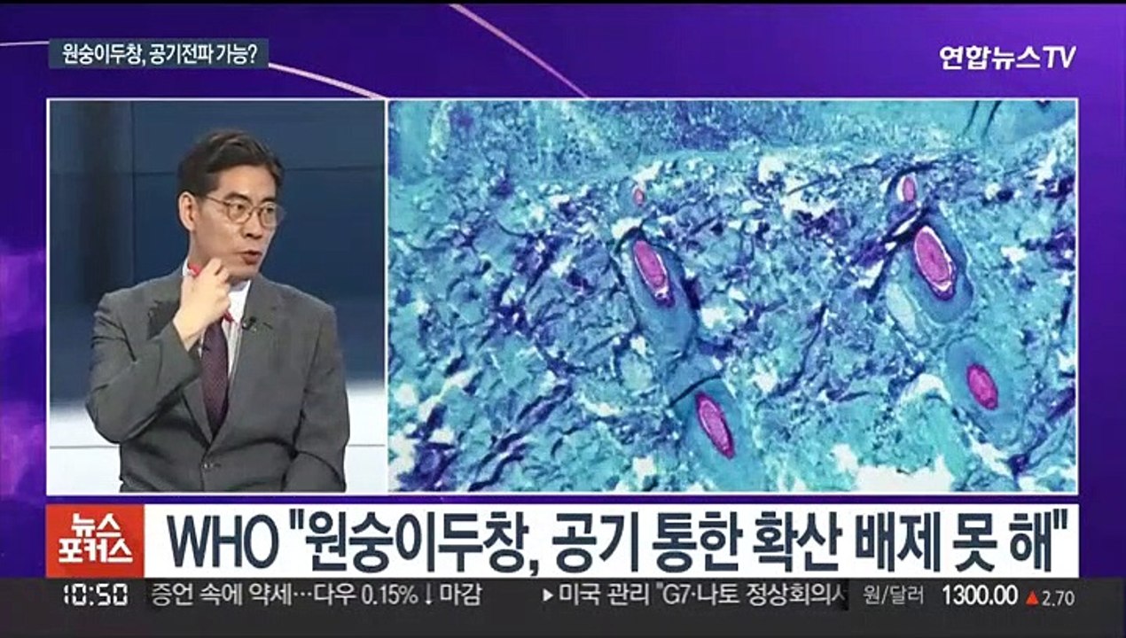 [뉴스포커스] 원숭이두창 국내 첫 확진…'주의'로 격상