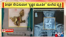 Man Accidentally Swallows Statue Of Lord Krishna In Belagavi | Public TV