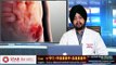 Inguinal Hernia | Groin Hernia | Laparoscopic Surgery for Groin Inguinal / Groin Hernia | Key Hole