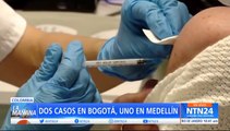 3 casos de viruela del mono en Colombia