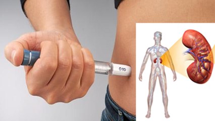 Diabetes Patients का Kidney Fail कैसे रोक सकते है, Nephropathy क्या है | Boldsky *Health