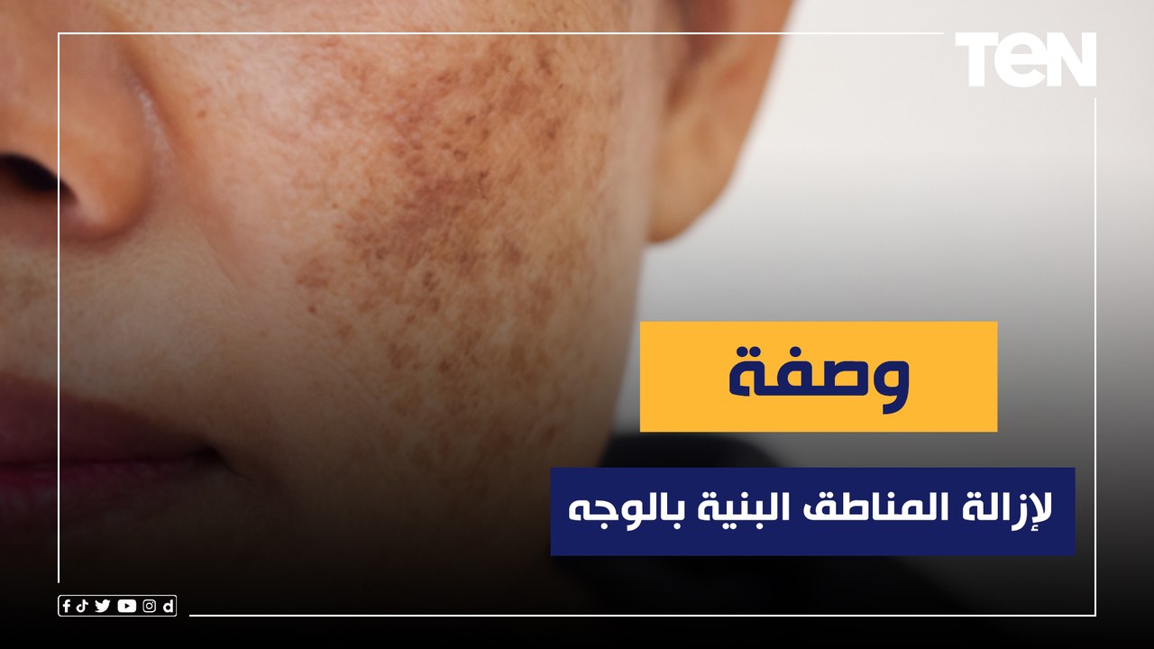 وصفة طبيعية لعلاج المناطق البنية في الوجه