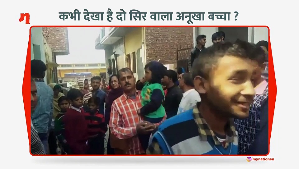 दो सिर और दो दिल और चार हाथ वाले बच्चे के विजुअल, सिर्फ माय नेशन पर