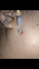 Organic Skin Solution Serum flattens down moles and spots without leaving any scars