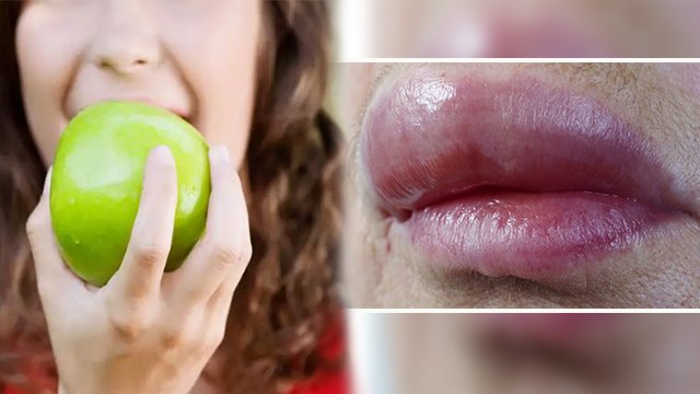 हरा सेब खाने के नुकसान । हरा सेब खाने से क्या होता है । Boldsky । *Health