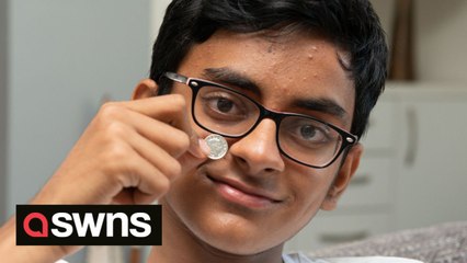 UK schoolboy blows 5p coin out of his nose - which was stuck there for 10 YEARS