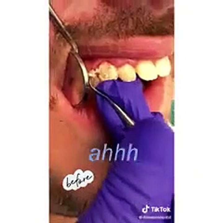 Most Extreme Beauty Treatments 2022 Best Smart and Helpful Beauty Hacks
