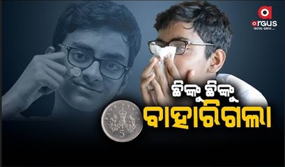 Boy who got Coin Stuck Up in Nose Sneezes it Out after 10 Years