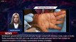Monkeypox Vaccine Being Offered to Some in New York: Here's What We Know About the Disease - 1breaki