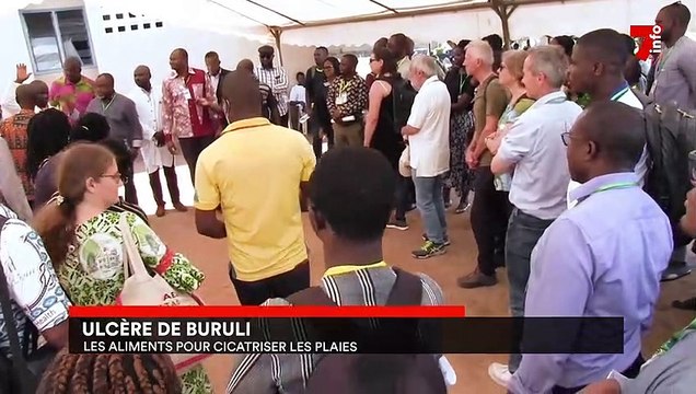 Ulcère de Burili : les aliments pour cicatriser les plaies