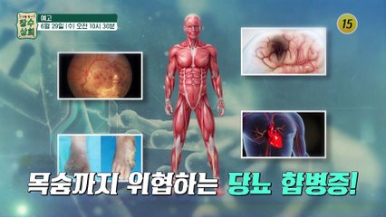 당뇨 탈출! 체지방 탈출! 건강 비법_장수상회 5회 예고 TV CHOSUN 220629 방송