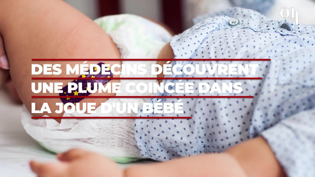 Une plume retrouvée coincée dans la joue d'un bébé de 7 mois aux États-Unis, l'enfant opérée en urgence