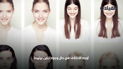 اختلاف الوجه