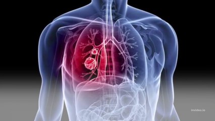 Kangker Paru-Paru, kapalan dan wasir, rontok dengan ini, insya allah.