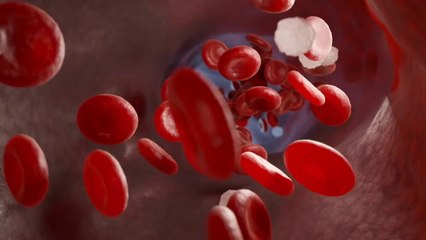 Beta-Talassemia, in Sicilia una rete per il trattamento