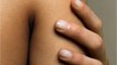 Ever wondered what causes goosebumps? Here’s how they are caused