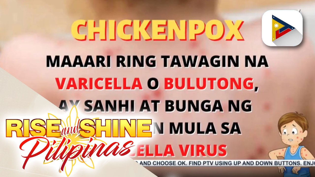 ALAMIN | Ano ang sakit na chickenpox - video Dailymotion