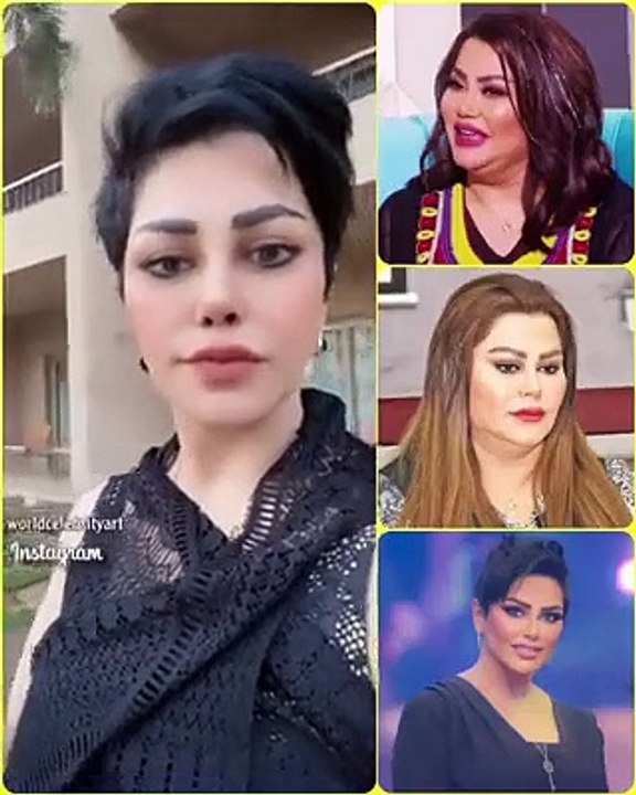 الكويتية فاطمه الطباخ قبل وبعد عملية التكميم