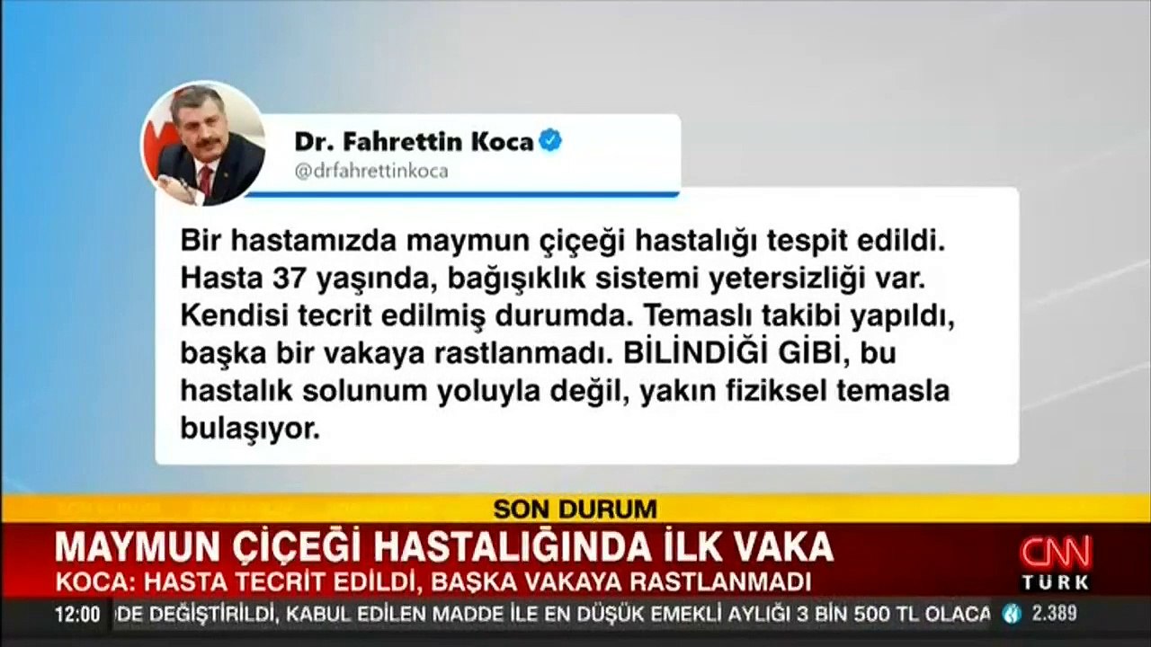 Son dakika... Bakan Koca açıkladı! Maymun çiçeği virüsü Türkiye'de