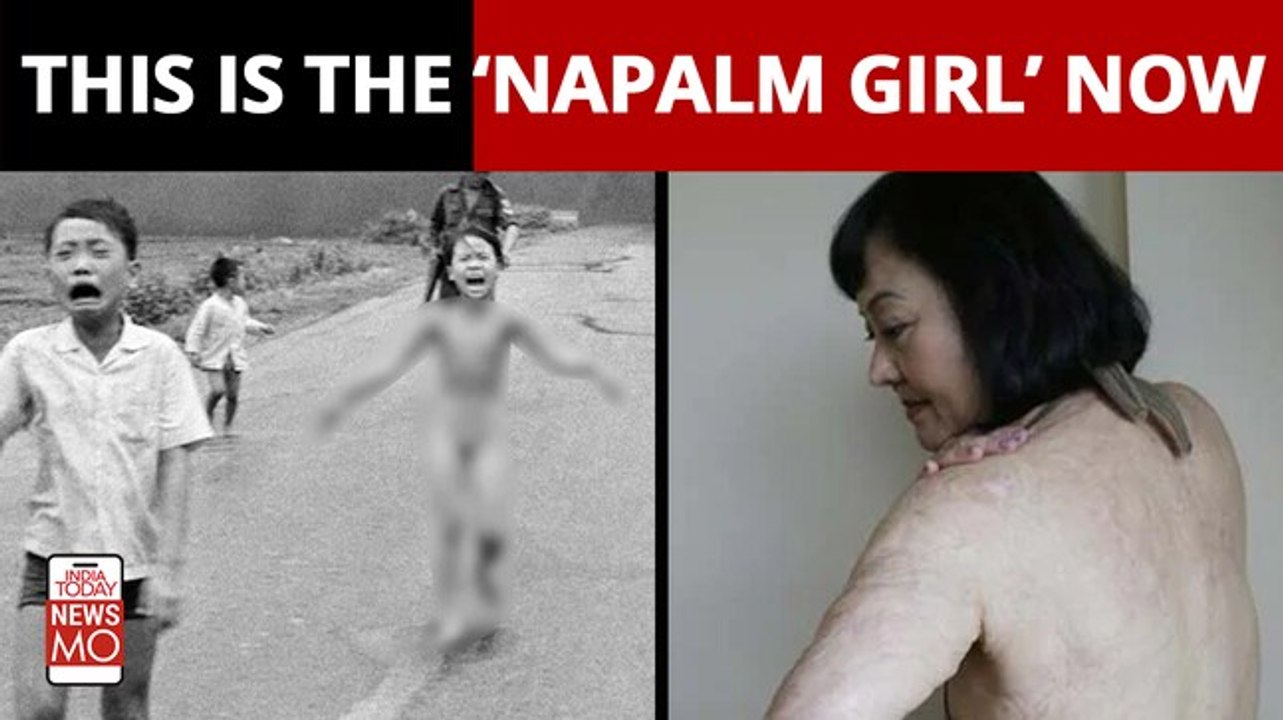 Vietnam war: After 50 years, ‘Napalm girl' in iconic Vietnam war photo gets final skin treatment in US