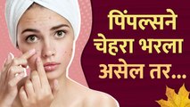 काय केल्याने पिंपल्स कमी होतील | How To Remove Pimples Overnight | Pimples Removal Treatment