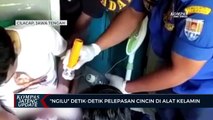 Ngilu Detik-detik Pelepasan Cincin di Alat Kelamin